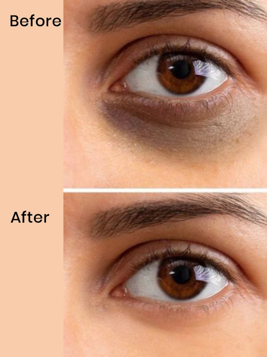 Under eye cream