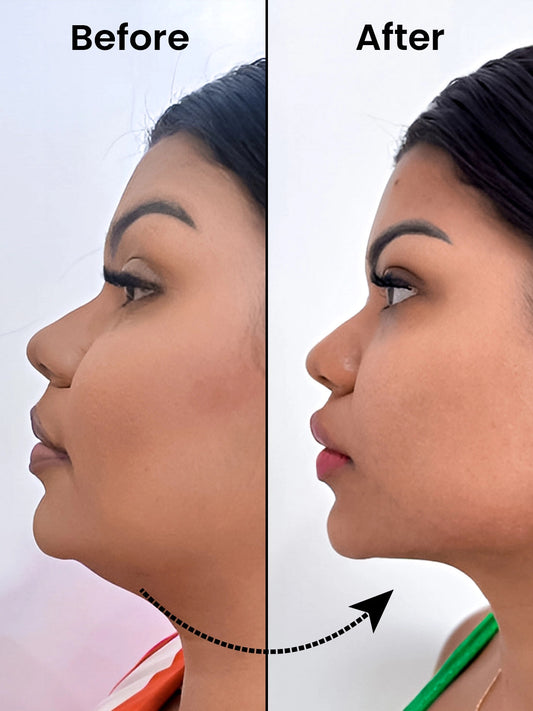 Chin up facial cellulite reduction kit